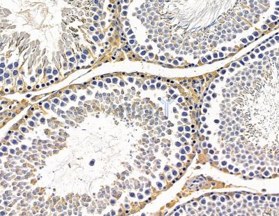 SPG7 Antibody - DF15355 at 1/100 staining rat testis tissue by IHC-P.
