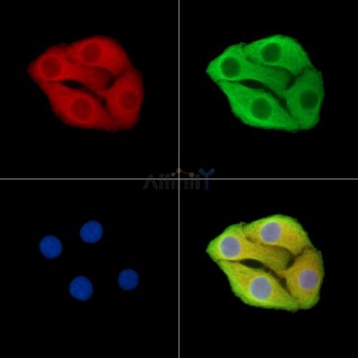 HPS6 Antibody - DF15359 staining Hela cells by IF/ICC.