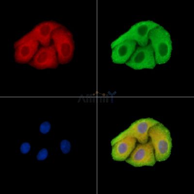 EIF4G3 Antibody - DF15361 staining Hela cells by IF/ICC.