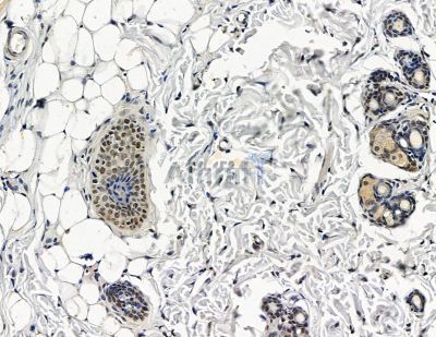 EIF4G3 Antibody - DF15361 at 1/100 staining rat skin tissue by IHC-P.