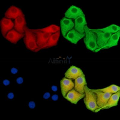 GFPT2 Antibody - DF15367 staining Hela cells by IF/ICC.