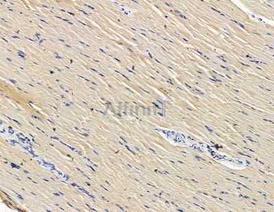 GFPT2 Antibody - DF15367 at 1/100 staining rat muscle tissue by IHC-P.