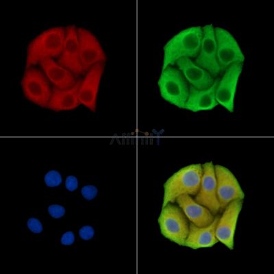 LIN7B Antibody - DF15368 staining Hela cells by IF/ICC.