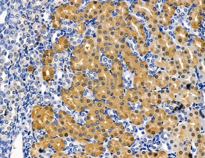 LIN7B Antibody - DF15368 at 1/100 staining rat kidney tissue by IHC-P.