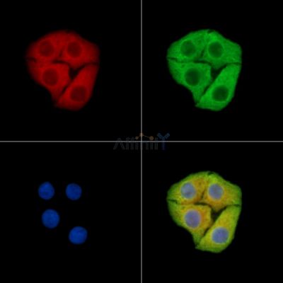 ARHGEF28 Antibody - DF15374 staining Hela cells by IF/ICC.