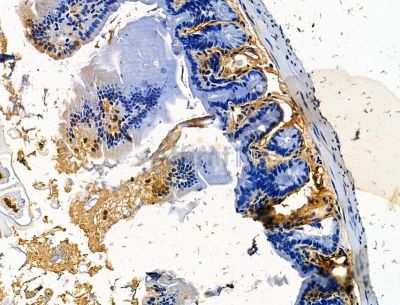 EDC3 Antibody - DF15381 at 1/100 staining mouse colorectal tissue by IHC-P.
