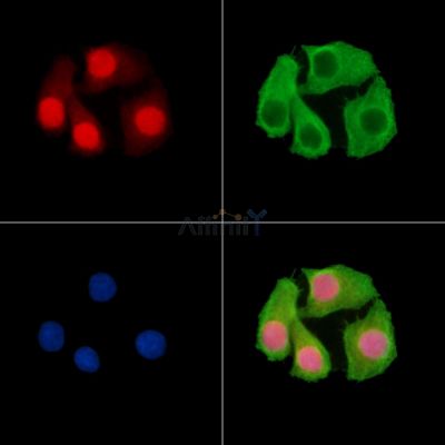 ZNF423 Antibody - DF15383 staining Hela cells by IF/ICC.