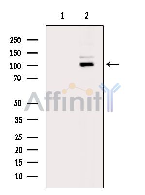 FBXO11 Antibody - Western blot analysis of extracts from Hela cells(heat-shock treatment), using FBXO11 Antibody.