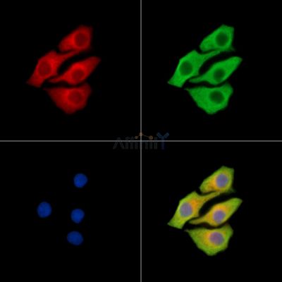 TANGO2 Antibody - DF15402 staining Hela cells by IF/ICC.