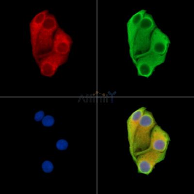 DENND2D Antibody - DF15406 staining Hela cells by IF/ICC.
