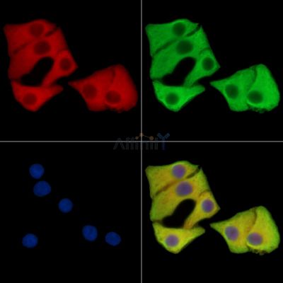 CCDC124 Antibody - DF15408 staining Hela cells by IF/ICC.
