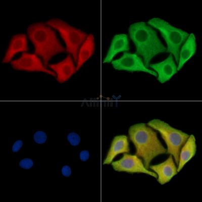 PUS10 Antibody - DF15409 staining Hela cells by IF/ICC.