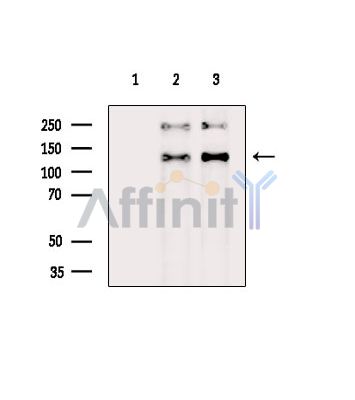 ATP13A1 Antibody - Western blot analysis of extracts from various samples, using ATP13A1 Antibody.