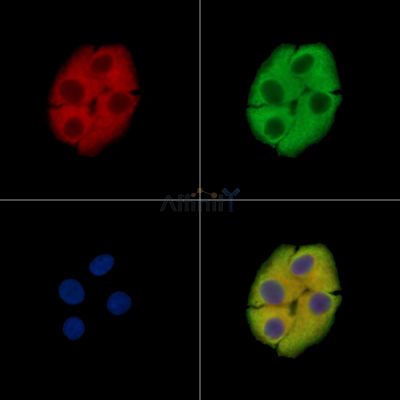 ATP13A1 Antibody - DF15410 staining Hela cells by IF/ICC.