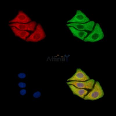 TOB2 Antibody - DF15413 staining Hela cells by IF/ICC.