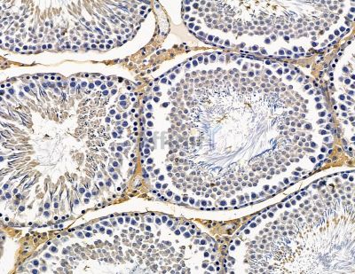 TOB2 Antibody - DF15413 at 1/100 staining rat testis tissue by IHC-P.