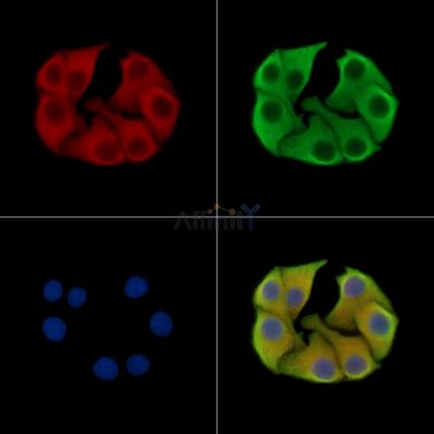 PYCR2 Antibody - DF15414 staining Hela cells by IF/ICC.