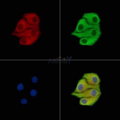 TRMT1 Antibody - DF15415 staining Hela cells by IF/ICC.