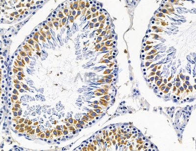 TRMT1 Antibody - DF15415 at 1/100 staining rat testis tissue by IHC-P.