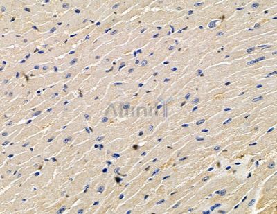 ABR Antibody - DF15416 at 1/100 staining mouse heart tissue by IHC-P.
