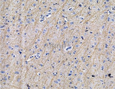 ABR Antibody - DF15416 at 1/100 staining rat brain tissue by IHC-P.