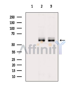 RORB Antibody - Western blot analysis of extracts from various samples, using RORB Antibody.