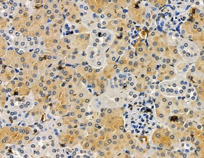 BBOX1 Antibody - DF15421 at 1/100 staining mouse kidney tissue by IHC-P.