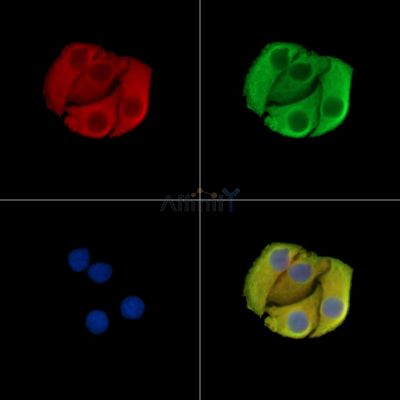 TWF2 Antibody - DF15422 staining Hela cells by IF/ICC.