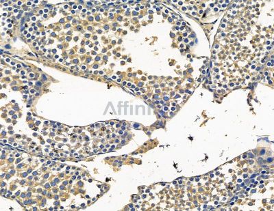 TWF2 Antibody - DF15422 at 1/100 staining mouse testis tissue by IHC-P.