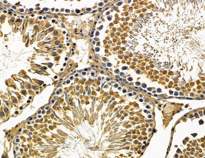 TWF2 Antibody - DF15422 at 1/100 staining rat testis tissue by IHC-P.