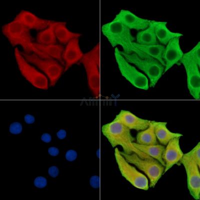 SDHD Antibody - DF15424 staining Hela cells by IF/ICC.
