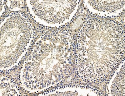 SGSM1 Antibody - DF15425 at 1/100 staining rat testis tissue by IHC-P.