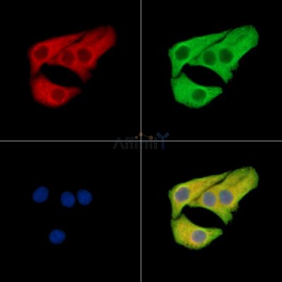 SLC12A6 Antibody - DF15430 staining Hela cells by IF/ICC.