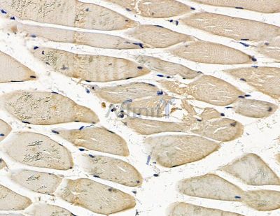 SLC12A6 Antibody - DF15430 at 1/100 staining mouse muscle tissue by IHC-P.