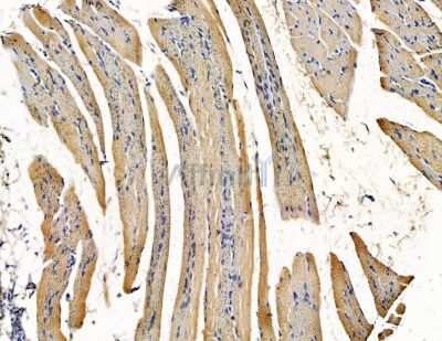 SLC12A6 Antibody - DF15430 at 1/100 staining rat muscle tissue by IHC-P.