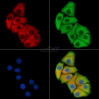 CARTPT Antibody - DF15431 staining Hela cells by IF/ICC.
