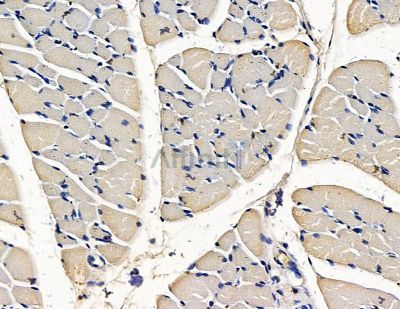 CARTPT Antibody - DF15431 at 1/100 staining rat muscle tissue by IHC-P.