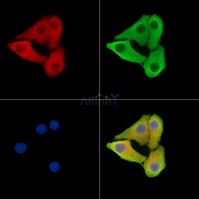 ARSD Antibody - DF15434 staining Hela cells by IF/ICC.