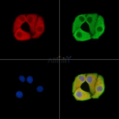 CKAP2 Antibody - DF15443 staining Hela cells by IF/ICC.