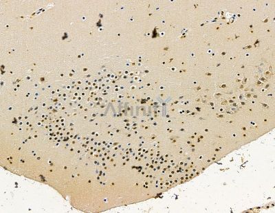 EGR4 Antibody - DF15444 at 1/100 staining mouse brain tissue by IHC-P.