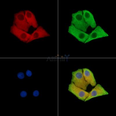 COG1 Antibody - DF15453 staining Hela cells by IF/ICC.