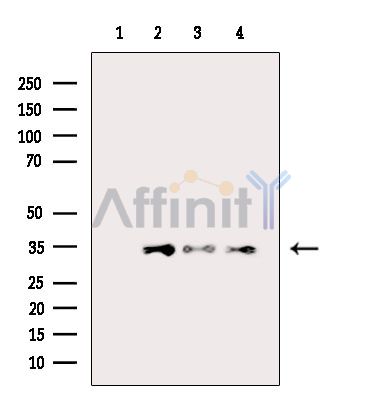 RARRES1 Antibody - Western blot analysis of extracts from various samples, using RARRES1 Antibody.