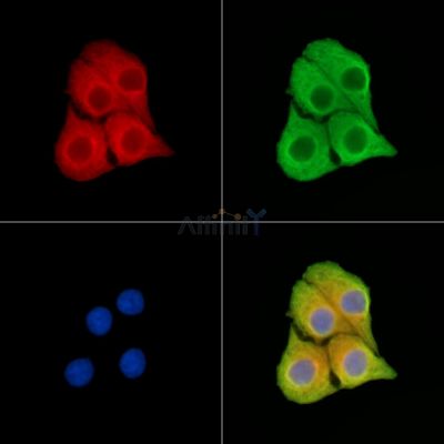 ASB2 Antibody - DF15456 staining Hela cells by IF/ICC.