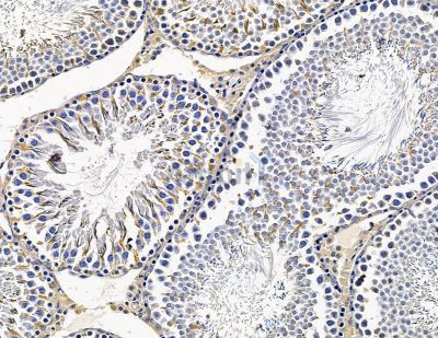 ASB2 Antibody - DF15456 at 1/100 staining rat testis tissue by IHC-P.