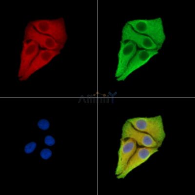 PARP8 Antibody - DF15458 staining Hela cells by IF/ICC.