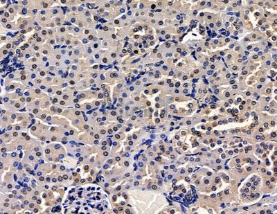 PARP8 Antibody - DF15458 at 1/100 staining mouse kidney tissue by IHC-P.