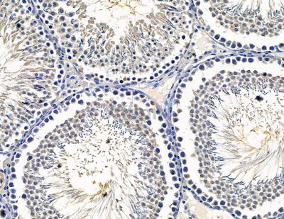 PAPPA Antibody - DF15466 at 1/100 staining rat testis tissue by IHC-P.