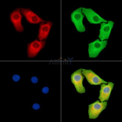 RPRML Antibody - DF15468 staining Hela cells by IF/ICC.