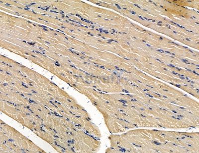 PODXL Antibody - DF15469 at 1/100 staining rat muscle tissue by IHC-P.