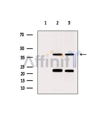 PPME1 Antibody - Western blot analysis of extracts from various samples, using PPME1 Antibody.